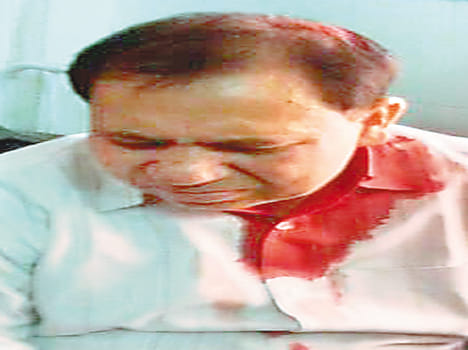 sdm bharthana injured in villagers stone throwing