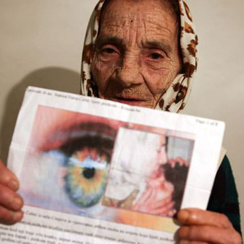 Woman Claims To Cure Blindness By Licking Her Tongue Into Eye
