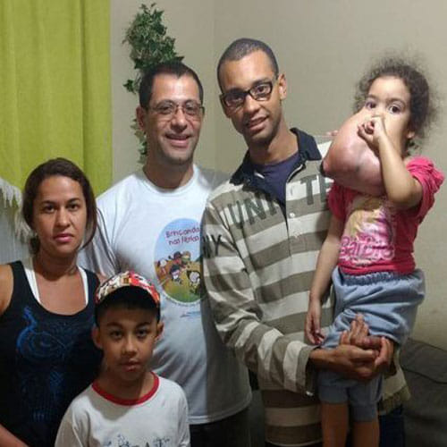 Girl In Brazil Had 2 Kg Tumour Now Has Been Revoverd
