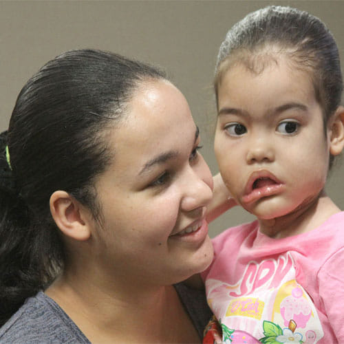 Girl In Brazil Had 2 Kg Tumour Now Has Been Revoverd
