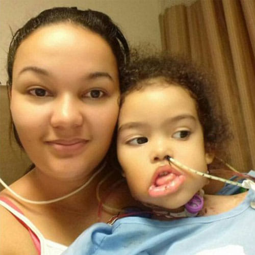 Girl In Brazil Had 2 Kg Tumour Now Has Been Revoverd