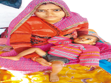 The baby appeared symptoms of polio