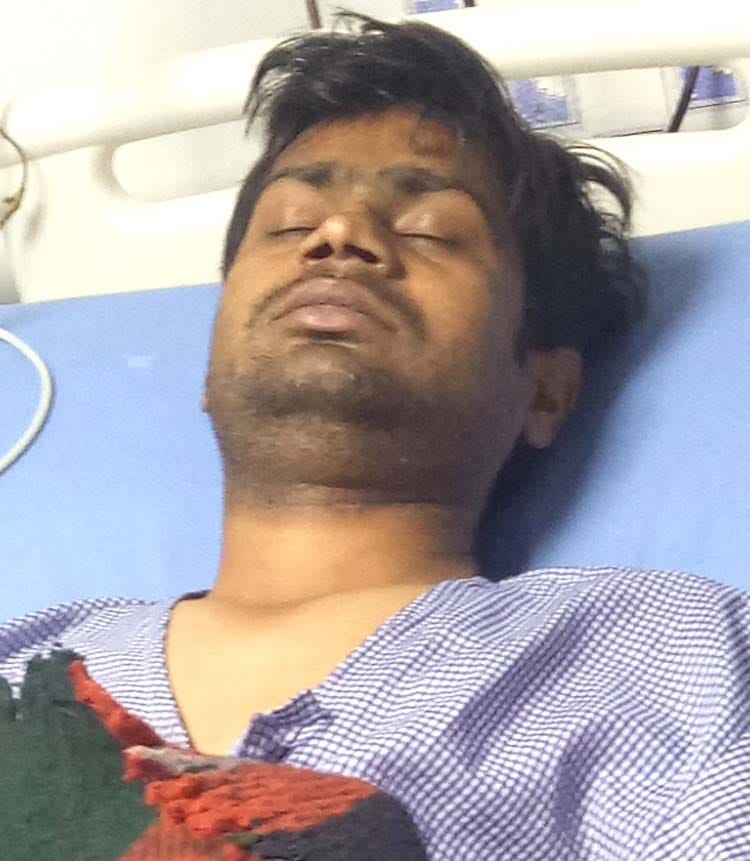 sdo get fainted due to work load