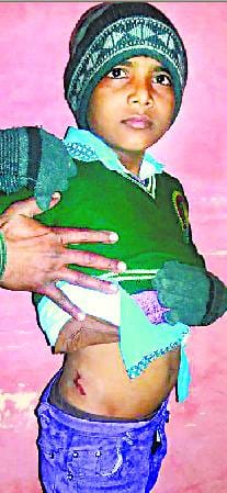 Bahedi offending dog again, the child scratched