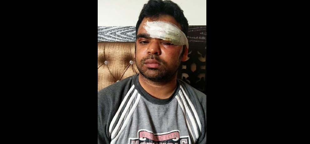 Music at the landlord has asked to brutally beat
