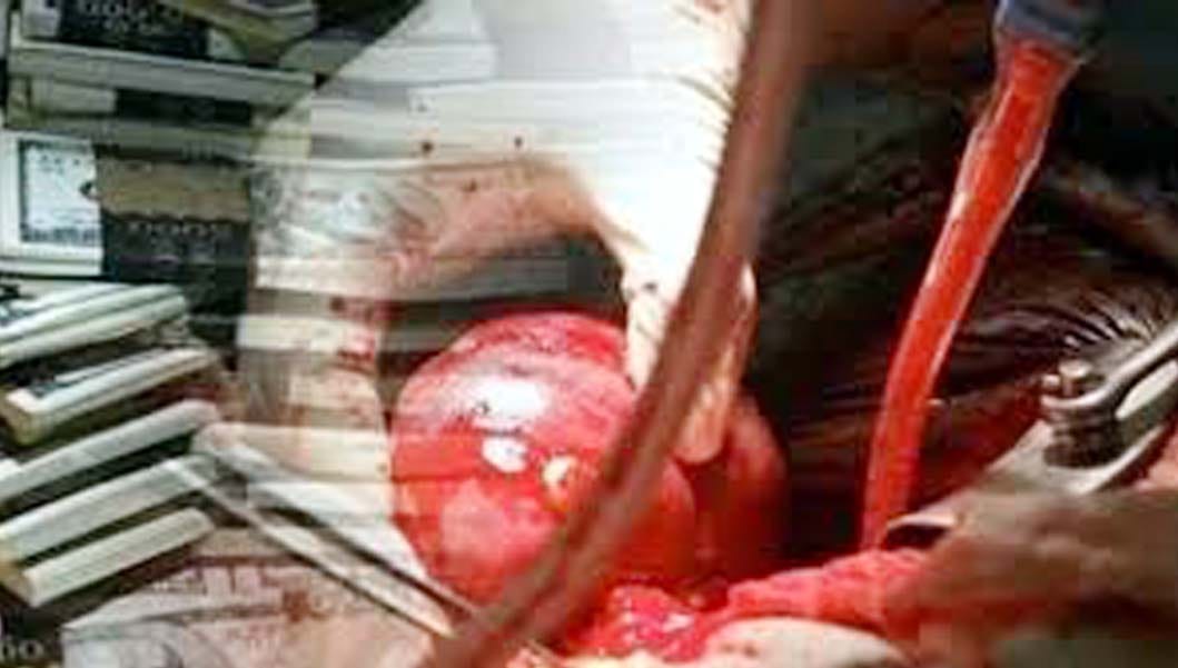 murder mystery solved before revealing human organ trafficking