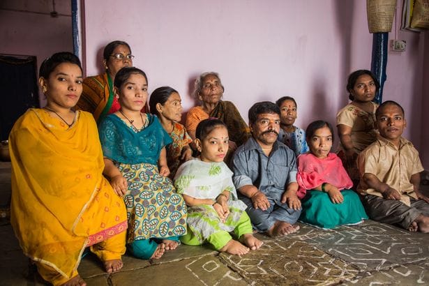 dwarf family of hyderabad