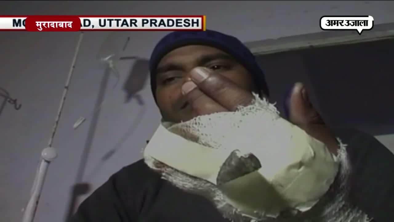 माफियाओं ने काटी रेलवे गार्ड की उंगलियां 