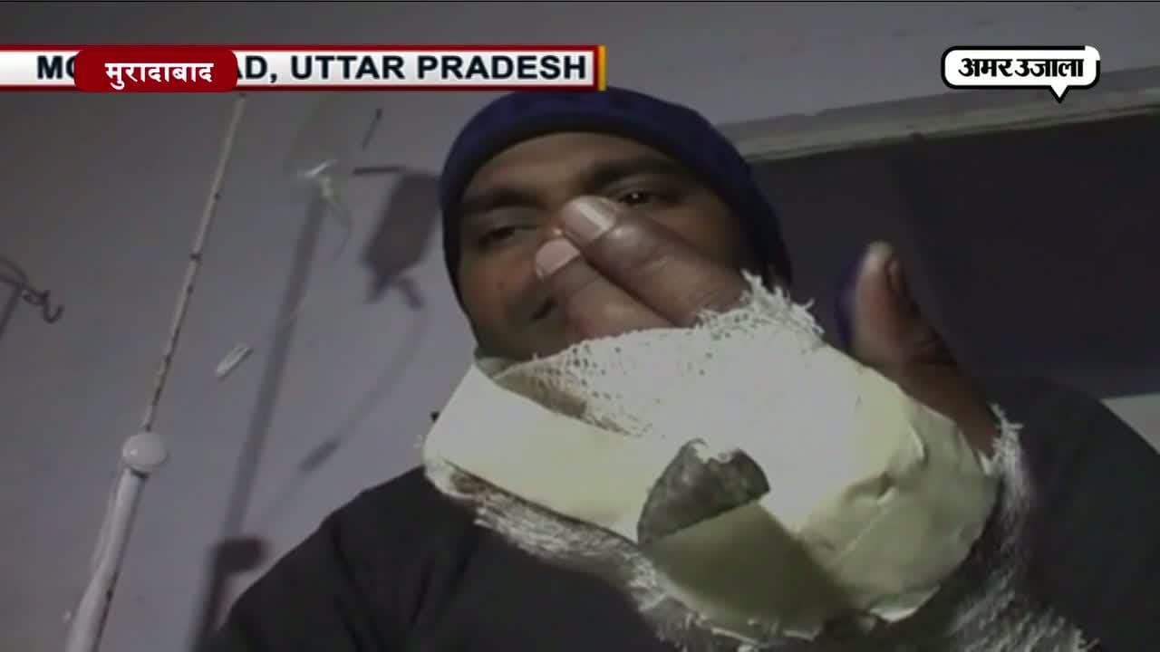 माफियाओं ने काटी रेलवे गार्ड की उंगलियां 