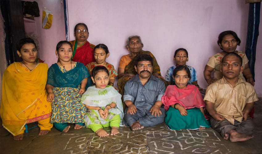 India's Biggest Dwarf Family Live Here