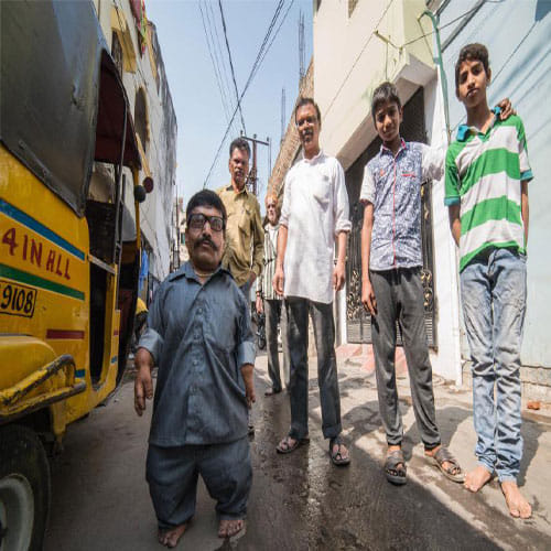 India's Biggest Dwarf Family Live Here