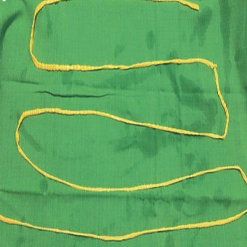 2 Meter Long Tapeworm Pulled Out Of A Man's Stomach