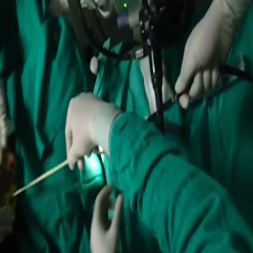 2 Meter Long Tapeworm Pulled Out Of A Man's Stomach