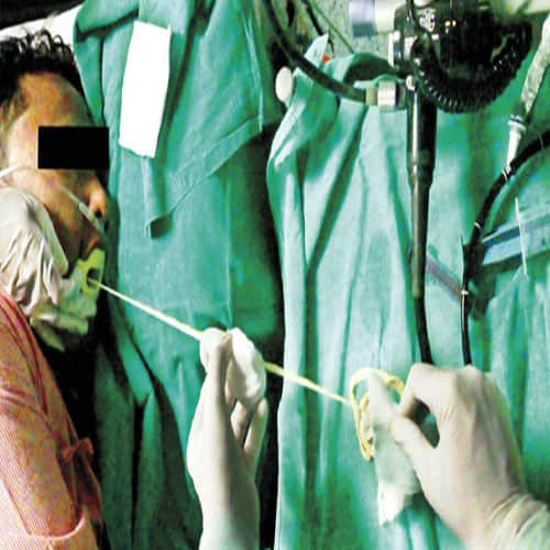 2 Meter Long Tapeworm Pulled Out Of A Man's Stomach