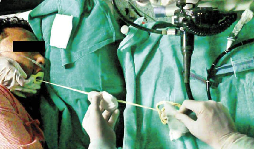 2 Meter Long Tapeworm Pulled Out Of A Man's Stomach