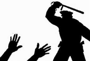 varanasi police implimented third dgree torchar to inocent thief