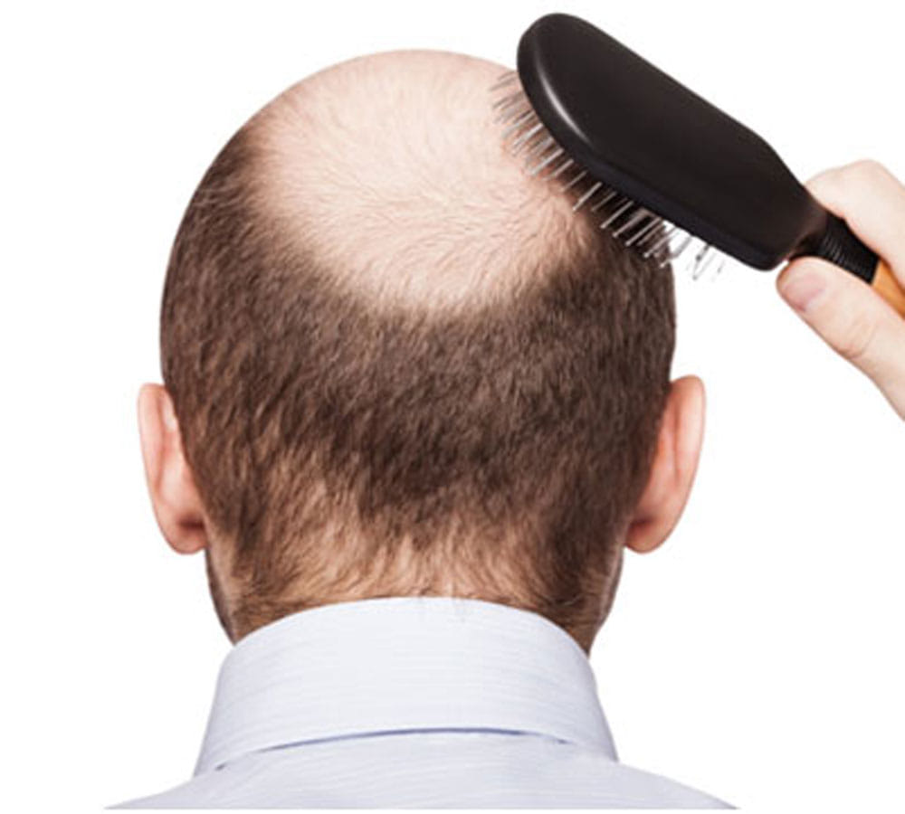 how to prevent hair fall immediately