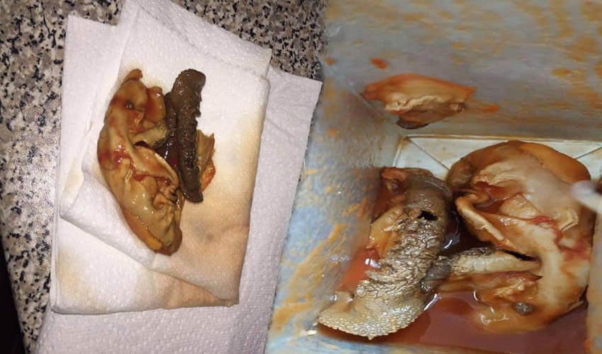 Woman Found A Fetus In Aldi Tomato Juice Can