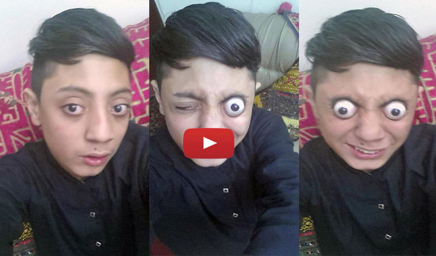 Bizzare Talent Of Boy In Pakistan Can Pop His Eyes Out From Socket For 10mm