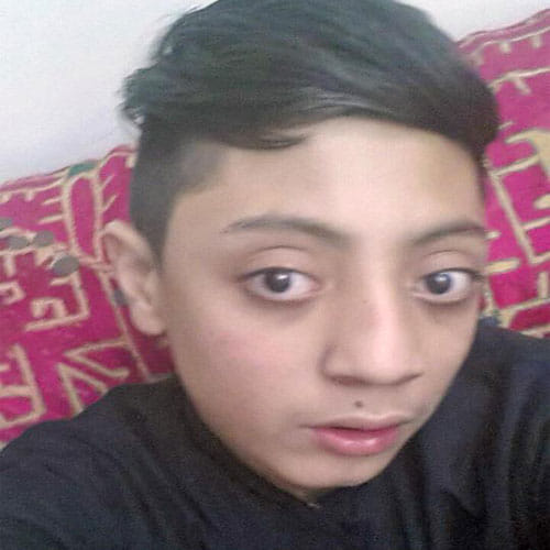 Bizzare Talent Of Boy In Pakistan Can Pop His Eyes Out From Socket For 10mm
