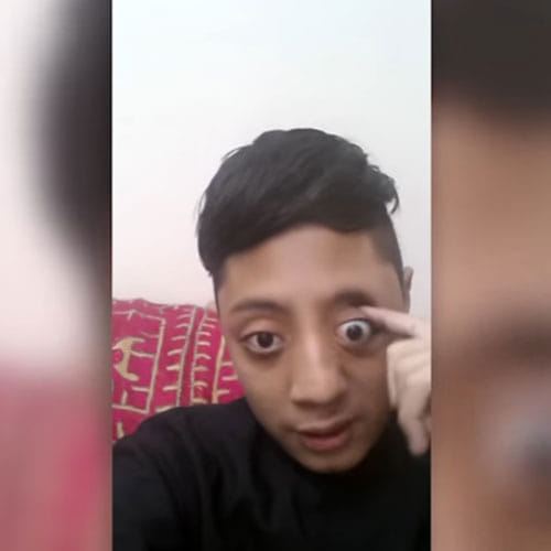 Bizzare Talent Of Boy In Pakistan Can Pop His Eyes Out From Socket For 10mm