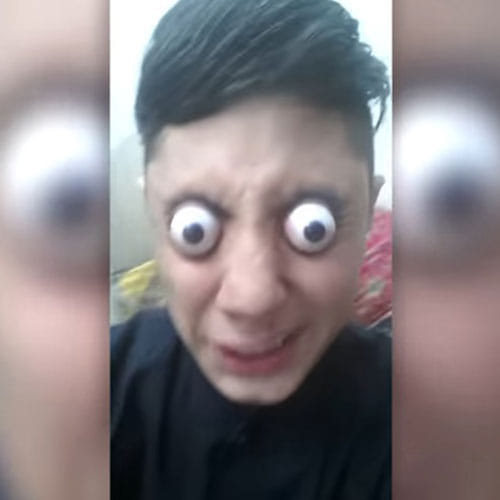 Bizzare Talent Of Boy In Pakistan Can Pop His Eyes Out From Socket For 10mm