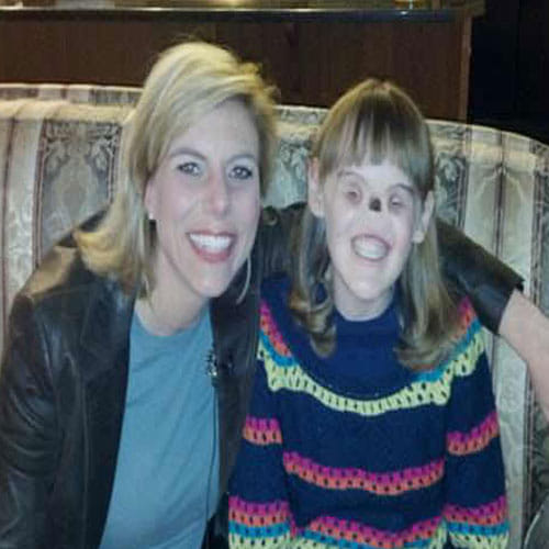 Cassidy Hooper-Girl Born Without Eyes And Nose Now Goes To College