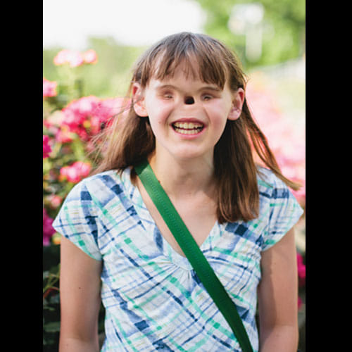 Cassidy Hooper-Girl Born Without Eyes And Nose Now Goes To College