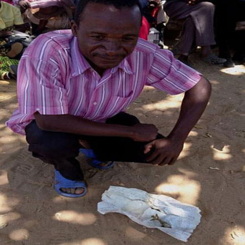 Woman In Zimbabwe Gave Birth To A Frog Like Baby 