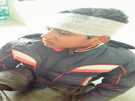 Nilgai bike rider hit by injuries