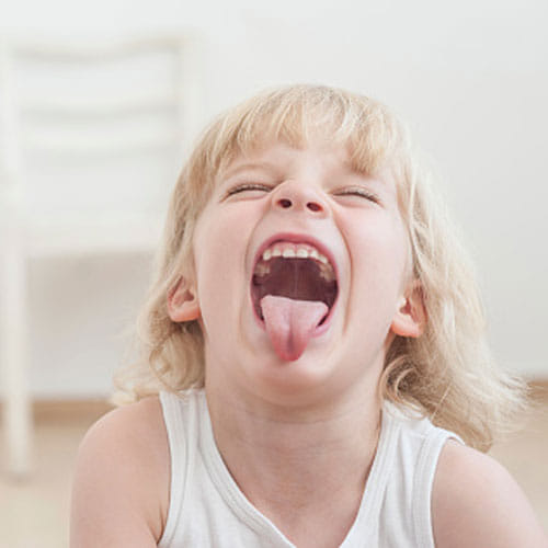 Tongue Color tells About Your Health