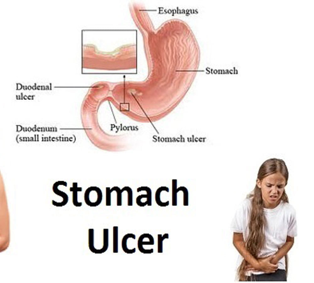 causes of stomach ache