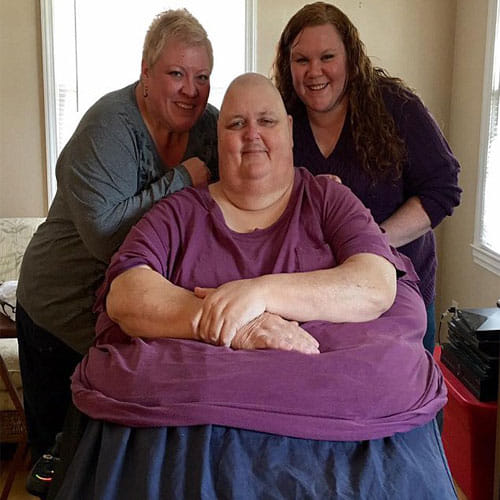 Man In America Got Operated After Found 64 Kg Tumour