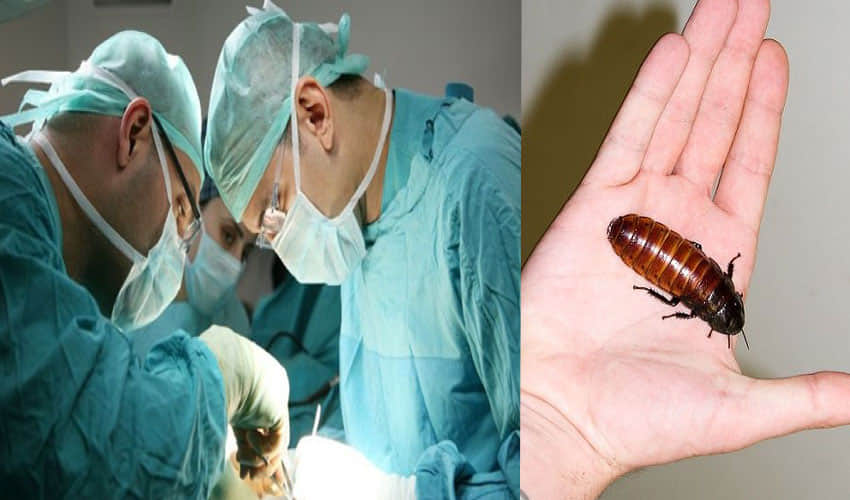 Alive Cockroach Found In Woman's Head In Tamil Nadu