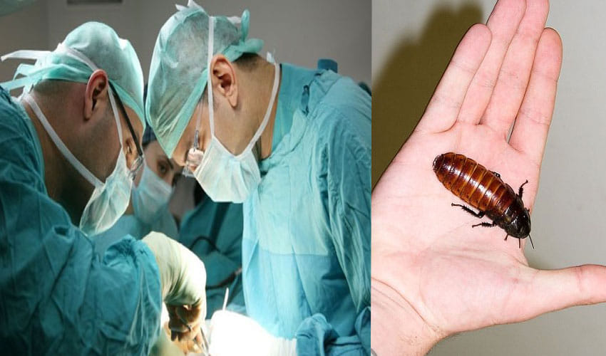 Alive Cockroach Found In Woman's Head In Tamil Nadu