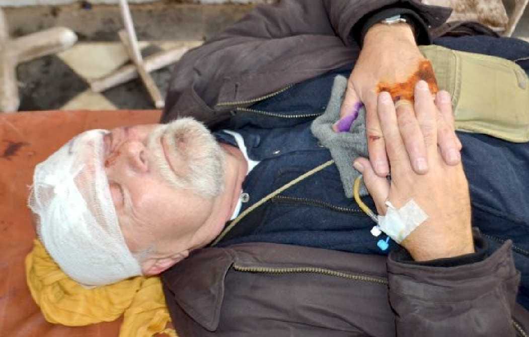 Foreign injured in a road accident, hospitalized