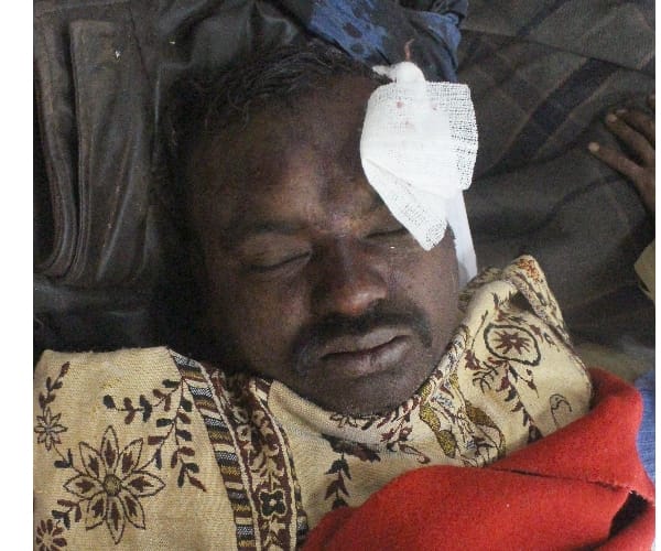  A man attacked for money in Lucknow.