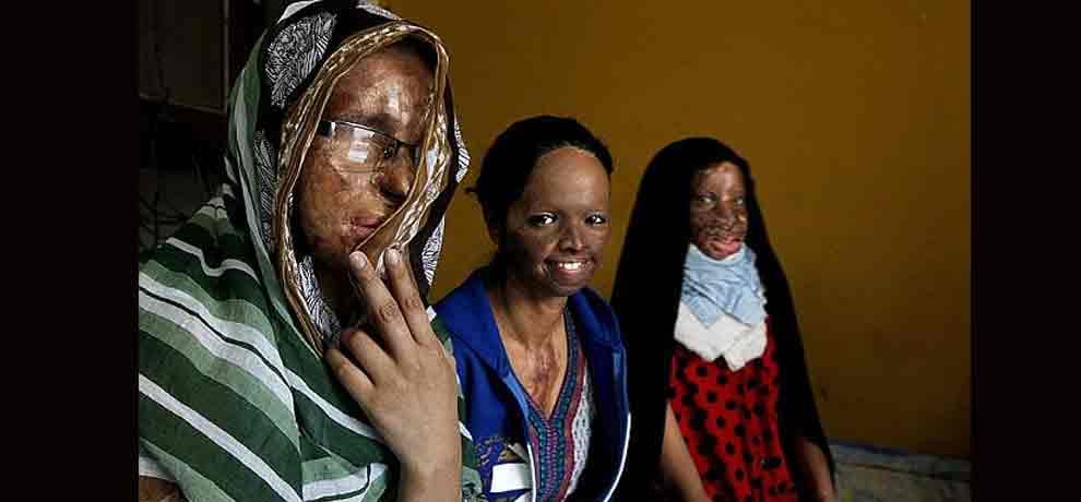 this kid has to sleep with one eye open': Terrified and 'forgotten' male survivors of acid attacks
