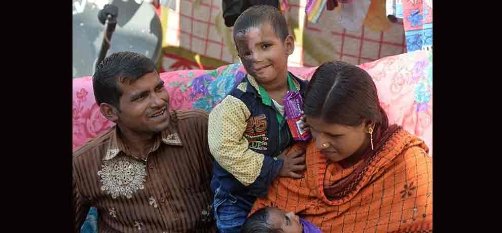 this kid has to sleep with one eye open': Terrified and 'forgotten' male survivors of acid attacks