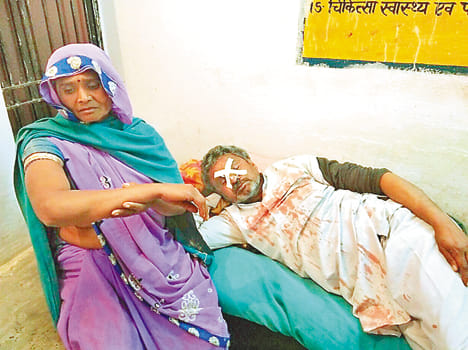 The couple refused to vote beaten