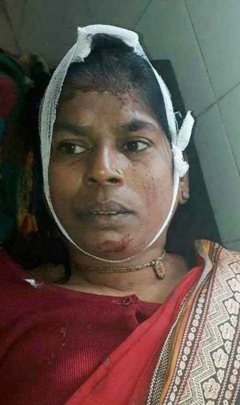 a mother and sister were wounded by the sword in varanasi Wounded by the sword