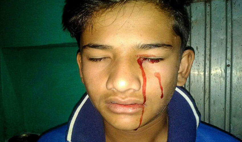Boy In Madhya Pradesh Bleeds From Body, Doctors Have No Idea About The Case