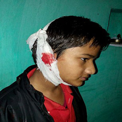 Boy In Madhya Pradesh Bleeds From Body, Doctors Have No Idea About The Case