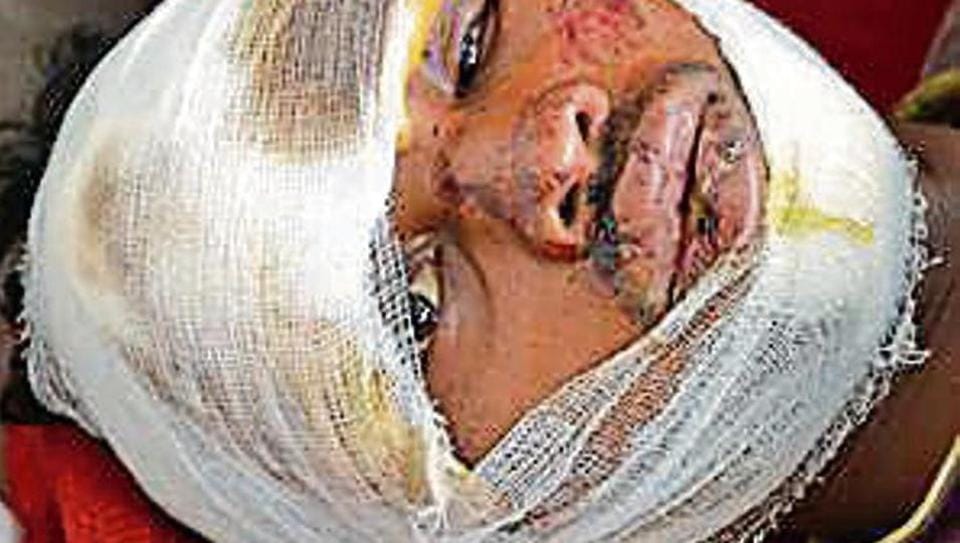 Patient critical after the doctor negligence:Jharkhand
