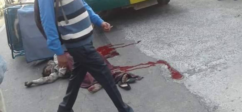 These photos will be blood smeared horrors of mankind, are also embarrassed, Catch
