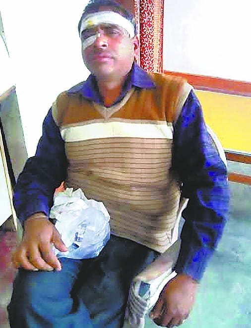 primary teacher beating