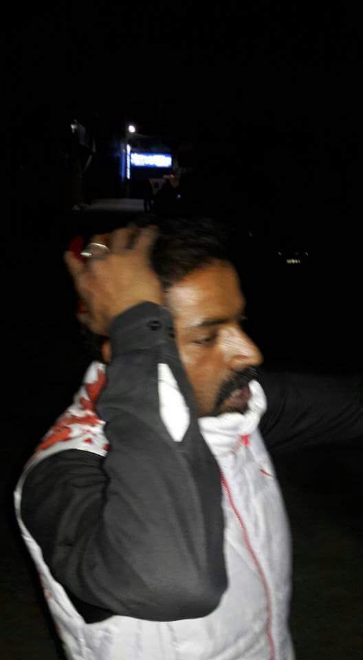 bjp and congress worker fight in kotdwar