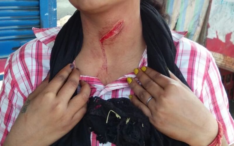 eve teaser attacked on girl in lucknow