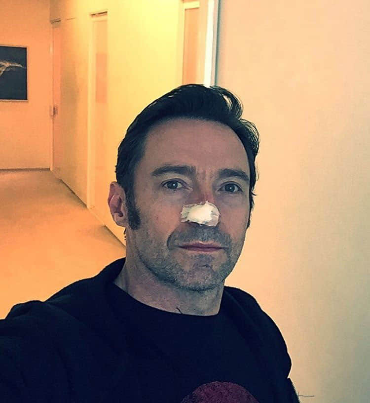 Hugh Jackman undergoes 6th surgery due to skin cancer
