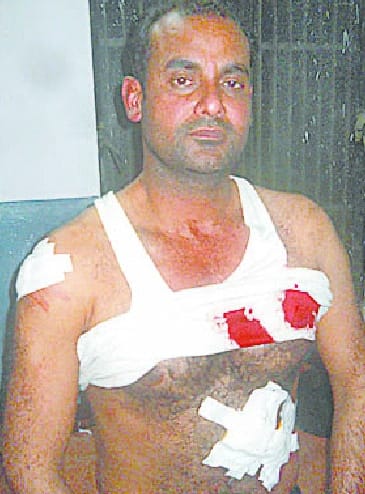 Teacher injured by miscreants looted